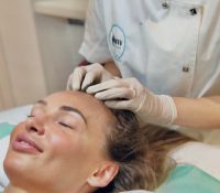 Microneedling Against Hair Loss

60 min | €130
Thi..